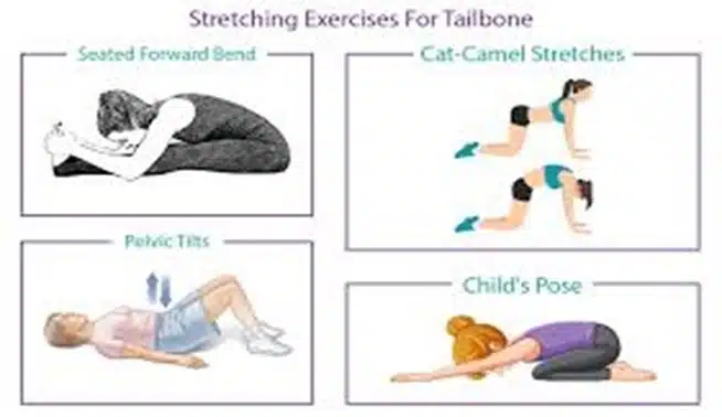 Exercises for coccydynia ( tail bone pain )